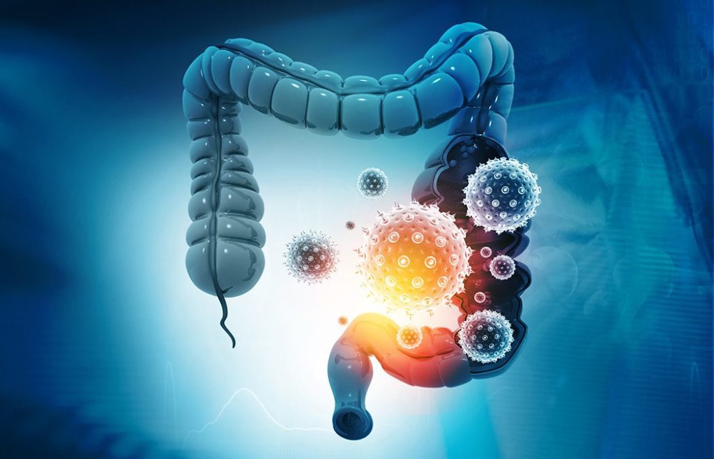 alt tagColonCancerBacteriasVirusesInSickUnhealthyIntestine3dIllustration