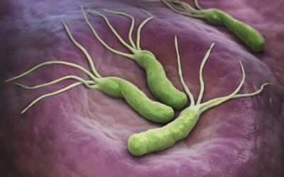 Common and Less Common H. Pylori Symptoms