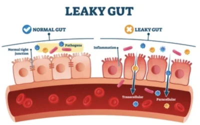 Leaky Gut 101
