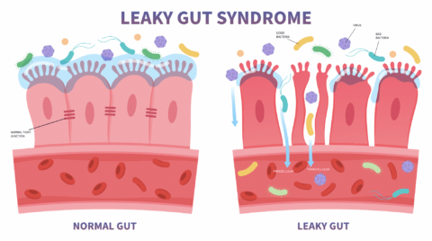What Causes Leaky Gut - Well Humans